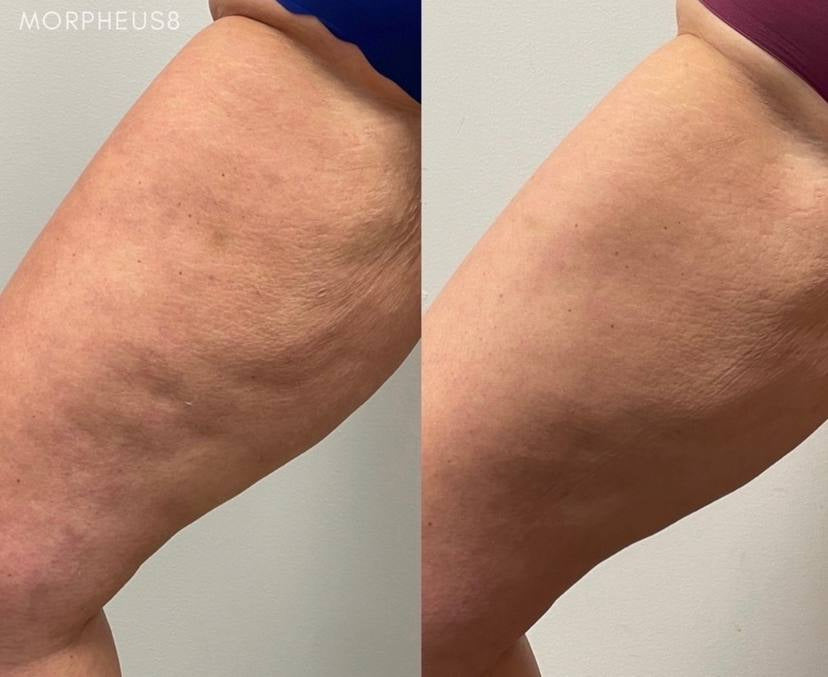 Immunya – Olio corpo ringiovanente