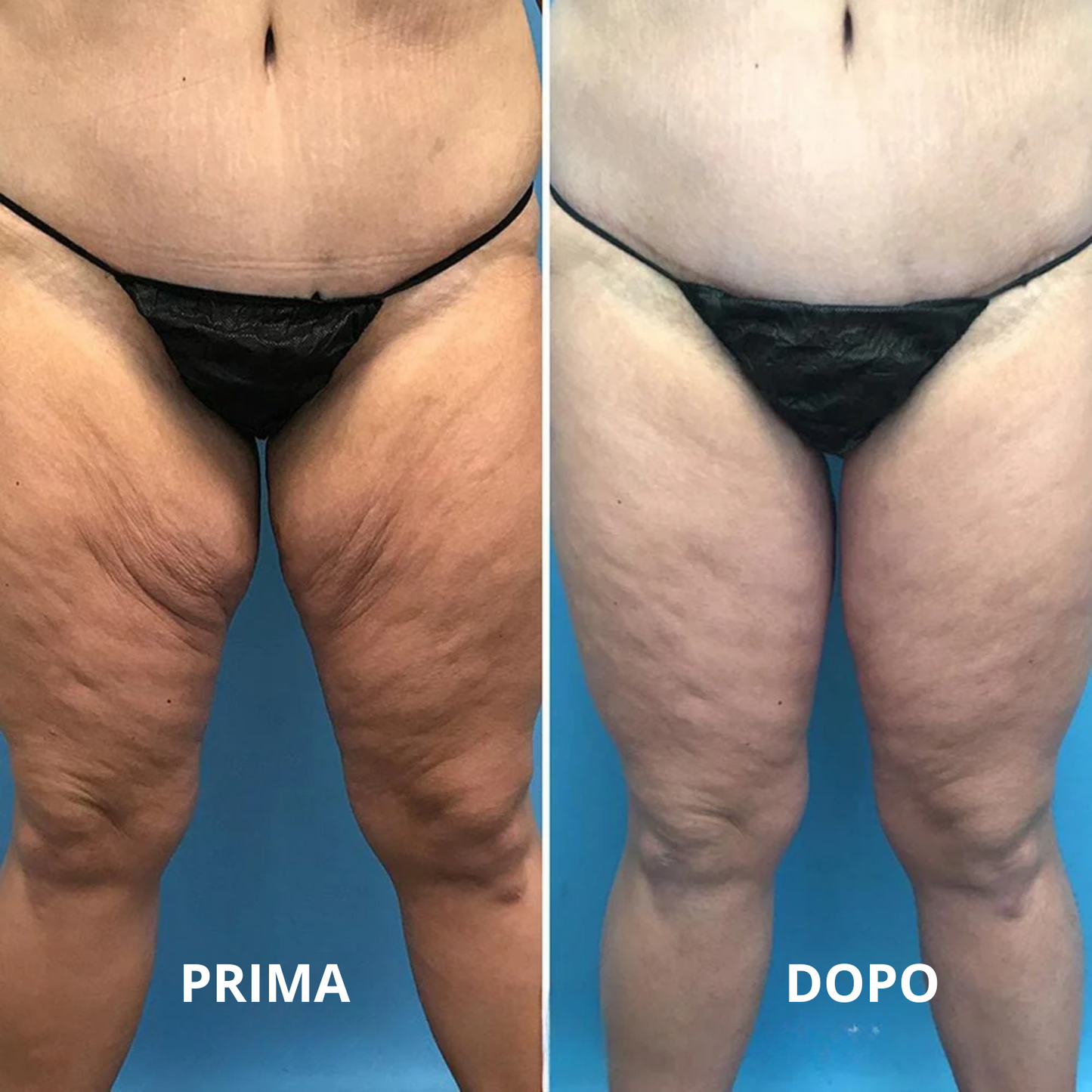 Immunya – Olio corpo ringiovanente