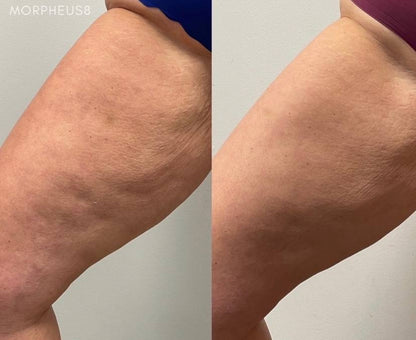 Immunya – Olio corpo ringiovanente