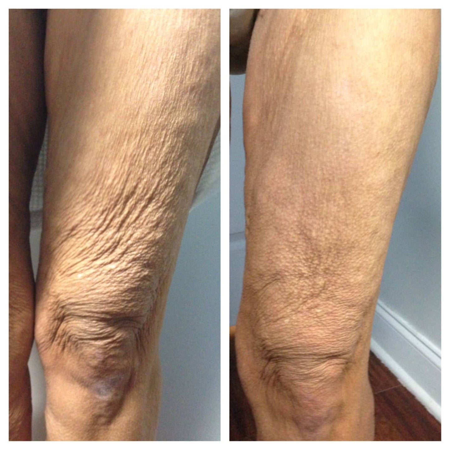 Immunya – Olio corpo ringiovanente