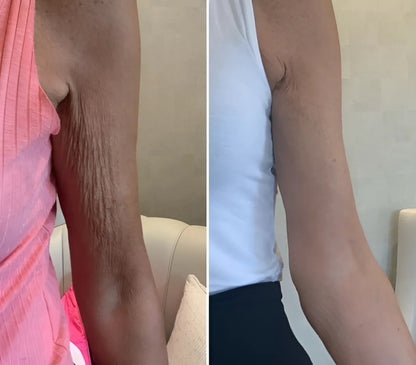 Immunya – Olio corpo ringiovanente